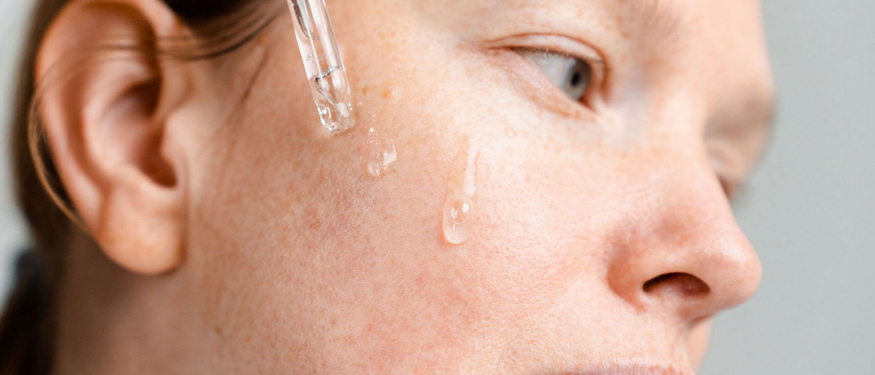 pigmentflecken frau gesicht pipette serum