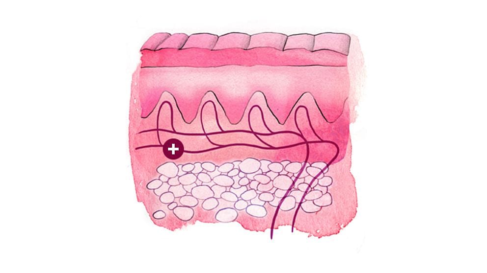 Illustration eines Hautquerschnitts: Lderhaut